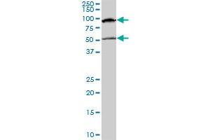 MECP2 monoclonal antibody (M01), clone 4B6. (MECP2 antibody  (AA 81-170))