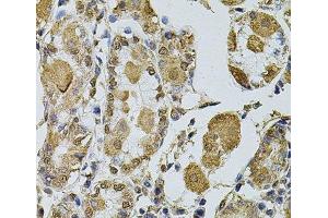 Immunohistochemistry of paraffin-embedded Human stomach using Cyclin A2 Polyclonal Antibody at dilution of 1:100 (40x lens). (Cyclin A antibody)