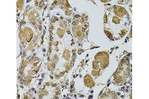 Immunohistochemistry of paraffin-embedded Human stomach using Cyclin A2 Polyclonal Antibody at dilution of 1:100 (40x lens). (Cyclin A antibody)