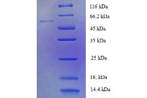 PDP2 Protein (AA 67-529) (His tag)