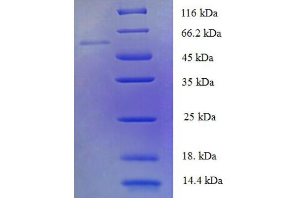 PDP2 Protein (AA 67-529) (His tag)