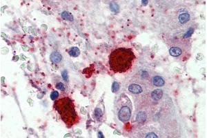 ABIN768626 (1. (CMA1 antibody  (Internal Region))