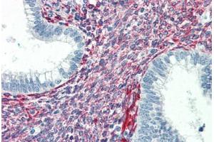 Human Uterus (formalin-fixed, paraffin-embedded) stained with SERPINH1 antibody ABIN364502 at 5 ug/ml followed by biotinylated anti-mouse IgG secondary antibody ABIN481714, alkaline phosphatase-streptavidin and chromogen. (SERPINH1 antibody)