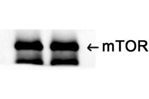 Western Blotting (WB) image for anti-Mechanistic Target of Rapamycin (serine/threonine Kinase) (mTOR) (Ser394) antibody (ABIN6282464)