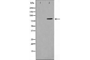 Western blot analysis of STAT1 expression in COLO205 whole cell lysates,The lane on the left is treated with the antigen-specific peptide. (STAT1 antibody)