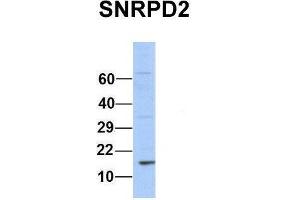 Host:  Rabbit  Target Name:  SNRPD2  Sample Type:  Human 293T  Antibody Dilution:  1. (SNRPD2 antibody  (Middle Region))
