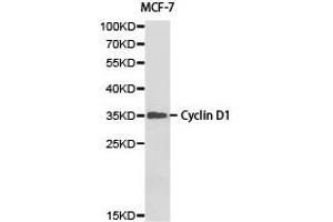 Western blot analysis of MCF-7 cell lysate ,using Cyclin D1 antibody. (Cyclin D1 antibody)