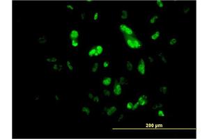 Immunofluorescence of monoclonal antibody to FOXA2 on HepG2 cell. (FOXA2 antibody  (AA 363-457))