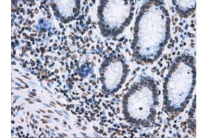 Image no. 7 for anti-ATP Synthase, H+ Transporting, Mitochondrial F1 Complex, beta Polypeptide (ATP5B) antibody (ABIN1496766) (ATP5B antibody)