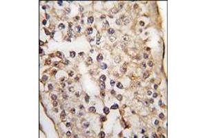 Formalin-fixed and paraffin-embedded human testis tissue reacted with PUM1 Antibody (C-term), which was peroxidase-conjugated to the secondary antibody, followed by DAB staining. (PUM1 antibody  (N-Term))