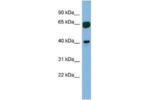 WB Suggested Anti-RAB3IL1 Antibody Titration: 0. (RAB3IL1 antibody  (Middle Region))