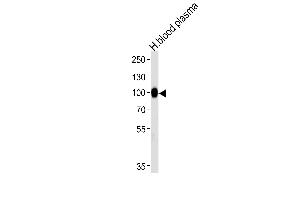 Western blot analysis of lysate from human blood plasma tissue lysate, using PLG Antibody at 1:1000 at each lane. (PLG antibody  (N-Term))