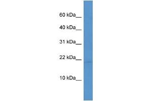 WB Suggested Anti-Hspb7  Antibody Titration: 0. (HSPB7 antibody  (C-Term))