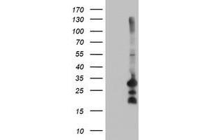 HEK293T cells were transfected with the pCMV6-ENTRY control (Left lane) or pCMV6-ENTRY REEP2 (Right lane) cDNA for 48 hrs and lysed. (REEP2 antibody)