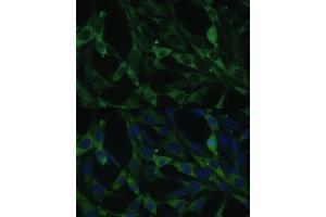 Immunofluorescence analysis of NIH-3T3 cells using CALU antibody (ABIN6129533, ABIN6137878, ABIN6137880 and ABIN6222201) at dilution of 1:100. (CALU antibody  (AA 20-315))
