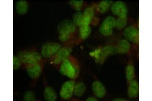 Immunostaining of HeLa cells showing specific labeling of their nuclei using our anti-nuclei antibody. (Nuclei antibody)