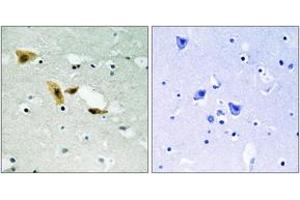 Immunohistochemistry analysis of paraffin-embedded human brain tissue, using APLF (Ab-116) Antibody. (APLF antibody  (AA 82-131))