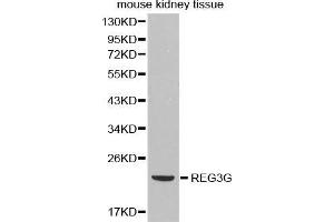 Western Blotting (WB) image for anti-Regenerating Islet Derived Protein 3 gamma (REG3g) antibody (ABIN3023038) (REG3g antibody)