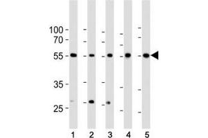 Western blot analysis of lysate from 1) HeLa, 2) K562, 3) MCF-7 cell line, 4) human liver and 5) mouse liver tissue lysate using BMPR1A antibody at 1:1000.
