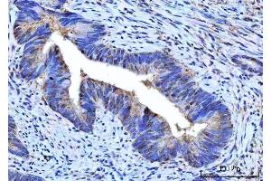 IHC analysis of RPS5 using anti-RPS5 antibody (ABIN7599076). (RPS5 antibody  (AA 1-204))