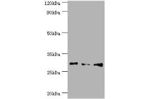 Western blot All lanes: Homeobox protein Hox-B5 antibody at 8 μg/mL Lane 1: HepG2 whole cell lysate Lane 2: Rat liver tissue Lane 3: Rat lung tissue Secondary Goat polyclonal to rabbit IgG at 1/10000 dilution Predicted band size: 29 kDa Observed band size: 29 kDa
