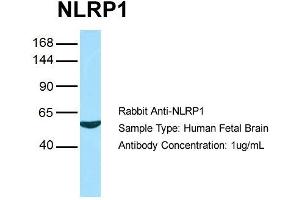 Host: Rabbit Target Name: NLRP1 Sample Type: Human Fetal Brain Antibody Dilution: 1.