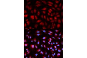 Immunofluorescence analysis of U2OS cells using PLK1 antibody. (PLK1 antibody)
