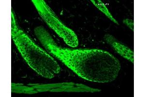 Immunohistochemistry (IHC) image for anti-Heat Shock Protein 70 (HSP70) antibody (ABIN361821)