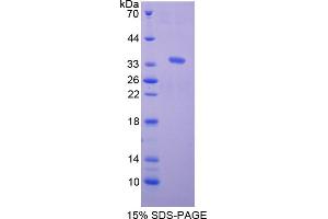 Image no. 1 for CD93 (CD93) (AA 82-369) protein (His tag) (ABIN6238038)
