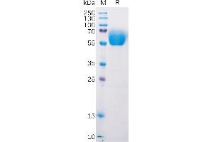 SDS-PAGE (SDS) image for B and T Lymphocyte Associated (BTLA) (AA 30-176) protein (mFc Tag) (ABIN7490631)