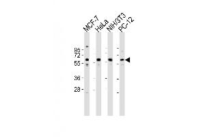 Western Blot at 1:2000 dilution Lane 1: MCF-7 whole cell lysates Lane 2: Hela whole cell lysates Lane 3: NIH/3T3 whole cell lysates Lane 4: PC-12 whole cell lysates Lysates/proteins at 20 ug per lane. (Pyruvate Kinase antibody  (N-Term))