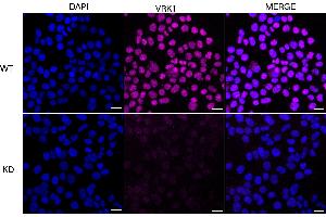 Immunocytochemical staining of HeLa cells using VRK1 antibody (ABIN7800811), 1:1,000), Top panel: wild-type (WT), Bottom panal: VRK1 shRNA knockdown (KD).