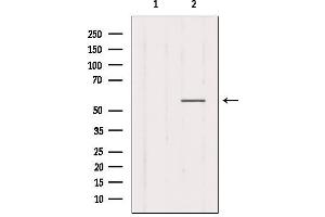 Western blot analysis of extracts from Mouse muscle, using CHRNG Antibody. (CHRNG antibody  (N-Term))