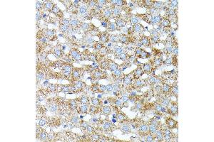 Immunohistochemistry of paraffin-embedded rat liver using Haptoglobin (Haptoglobin (HP)) antibody (ABIN3022157, ABIN3022158, ABIN1513029, ABIN1514188 and ABIN6218636) at dilution of 1:100 (40x lens). (Haptoglobin antibody)