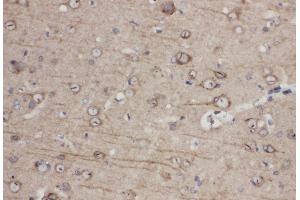 Anti-Eph receptor A1 antibody, IHC(P) IHC(P): Rat Brain Tissue (EPHA1 antibody  (C-Term))