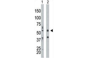 PKR antibody used in western blot to detect PRKR/PKR in mouse liver tissue lysate (Lane 1) and HepG2 cell lysate (2). (EIF2AK2 antibody  (AA 11-42))