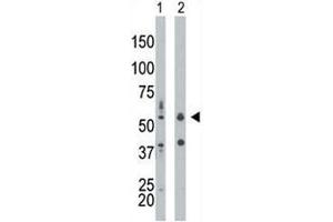 PKR antibody used in western blot to detect PRKR/PKR in mouse liver tissue lysate (Lane 1) and HepG2 cell lysate (2).