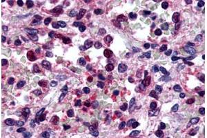 Anti-P2RY6 / P2Y6 antibody  ABIN1049221 IHC staining of human spleen, red pulp.
