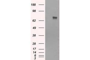Western Blotting (WB) image for anti-Bruton Agammaglobulinemia tyrosine Kinase (BTK) antibody (ABIN1496971) (BTK antibody)
