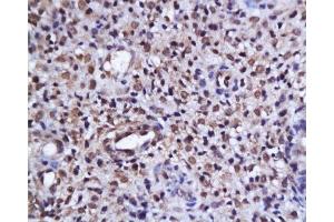 Formalin-fixed and paraffin embedded human endometrium tissue labeled with Anti-phospho-AKT/PKB(Ser473) Polyclonal Antibody, Unconjugated  at 1:200, followed by conjugation to the secondary antibody and DAB staining (AKT 1/2/3 antibody  (pSer473))