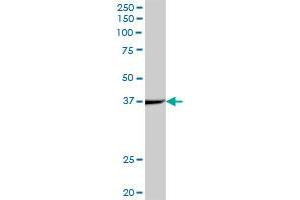 ACADS MaxPab polyclonal antibody. (ACADS antibody  (AA 1-412))