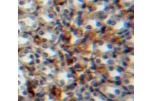 Used in DAB staining on fromalin fixed paraffin-embedded Kidney tissue (Vitamin D-Binding Protein antibody  (AA 17-476))