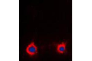 Immunofluorescent analysis of Adenosine A2a Receptor staining in Raw264. (Adenosine A2a Receptor antibody  (Center))
