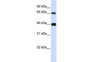 Western Blotting (WB) image for anti-Thymopoietin (TMPO) antibody (ABIN2458894) (Thymopoietin antibody)