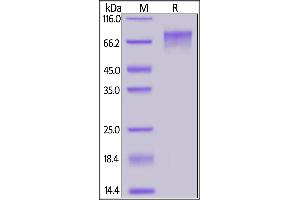 Cynomolgus GUCY2C, His Tag on  under reducing (R) condition. (GUCY2C Protein (AA 24-430) (His tag))