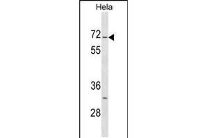 Western blot analysis in Hela cell line lysates (35ug/lane). (STK3 antibody  (C-Term))