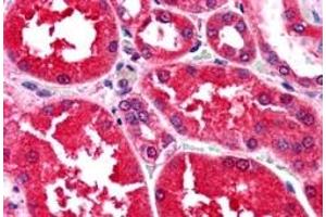 Immunohistochemistry (IHC) image for anti-Aldo-Keto Reductase Family 1, Member B1 (Aldose Reductase) (AKR1B1) antibody (ABIN5912019) (AKR1B1 antibody)