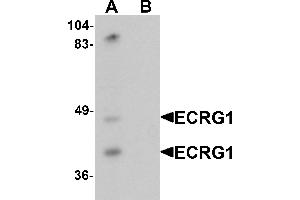 Western blot analysis of ECRG1 in mouse liver tissue lysate with ECRG1 antibody at 1 µg/mL in (A) the absence and (B) the presence of blocking peptide.