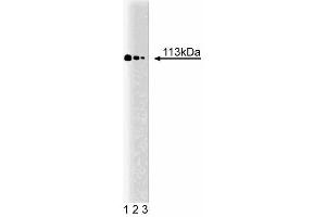 Western blot analysis of Stat2 on a K-562 cell lysate (Human bone marrow myelogenous leukemia, ATCC CCL-243). (STAT2 antibody  (AA 1-178))