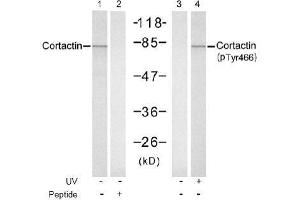 Image no. 1 for anti-Cortactin (CTTN) (pTyr466) antibody (ABIN197036)
